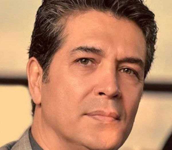 عکس یوسف مرادیان عمل زیبایی عکس یوسف مرادیان عمل زیبایی