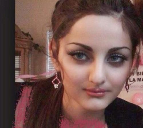 عکس مهلقا جابری قبل عمل 