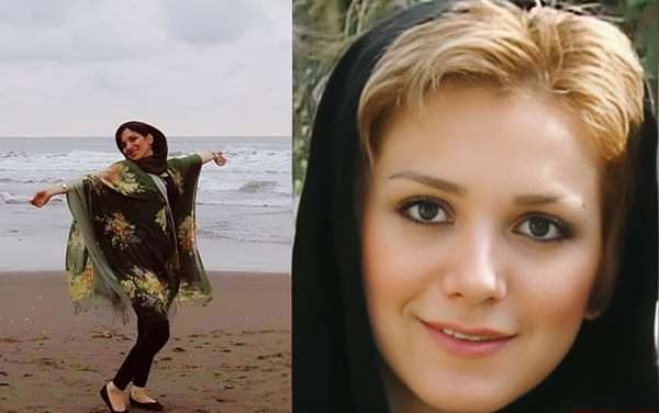 عکس نیوشا صارمی قبل از عمل