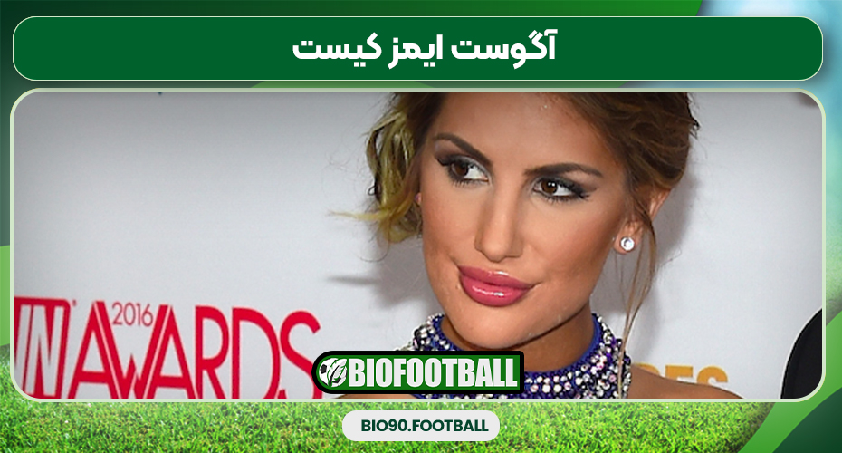 آگوست ایمز کیست 