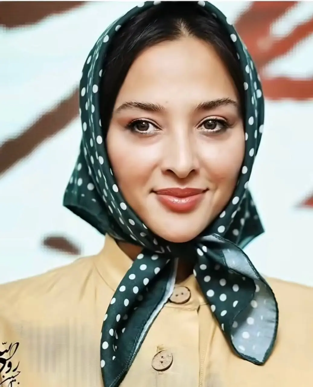 آناهیتا درگاهی قبل از عمل آناهیتا درگاهی قبل از عمل