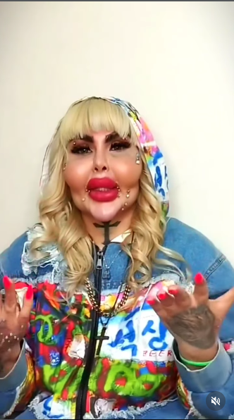 آناهیتا ناچو قبل عمل