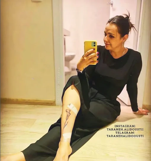 عکس سکسی ترانه علیدوستی