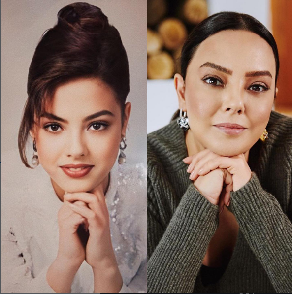 ابرو گوندش قبل و بعد از عمل زیبایی ابرو گوندش قبل و بعد از عمل زیبایی