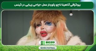 بیوگرافی آناهیتا ناچو رکوردار عمل جراحی زیبایی در گینس